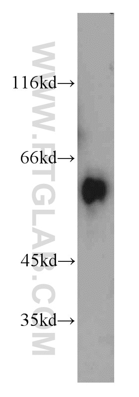 Western Blot (WB) analysis of mouse skeletal muscle tissue using ALDH4A1 Polyclonal antibody (11604-1-AP)