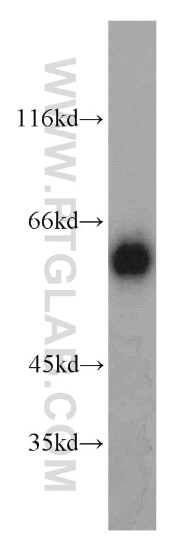 Western Blot (WB) analysis of human skeletal muscle tissue using ALDH4A1 Polyclonal antibody (11604-1-AP)