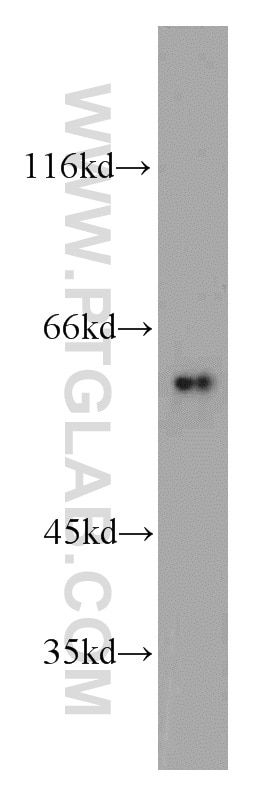 Western Blot (WB) analysis of mouse small intestine tissue using ALDH4A1 Polyclonal antibody (11604-1-AP)