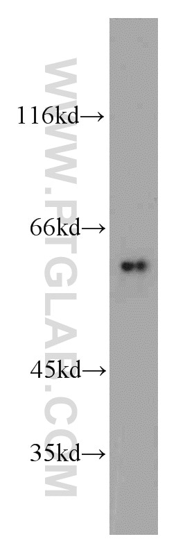 WB analysis of mouse small intestine using 11604-1-AP