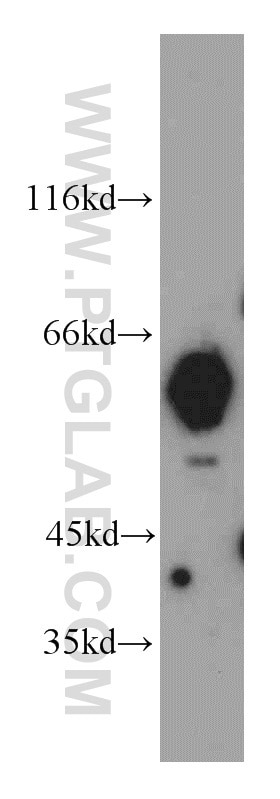 Western Blot (WB) analysis of HepG2 cells using ALDH4A1 Polyclonal antibody (11604-1-AP)