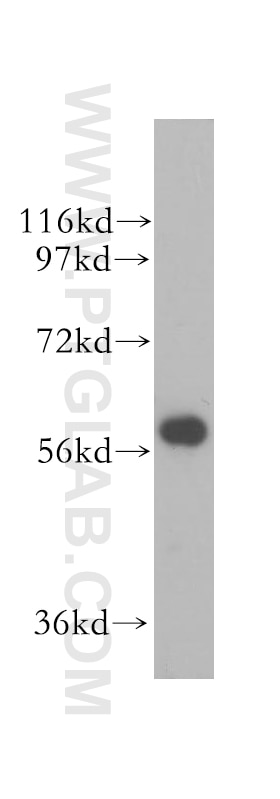 Western Blot (WB) analysis of human heart tissue using ALDH4A1 Polyclonal antibody (11604-1-AP)