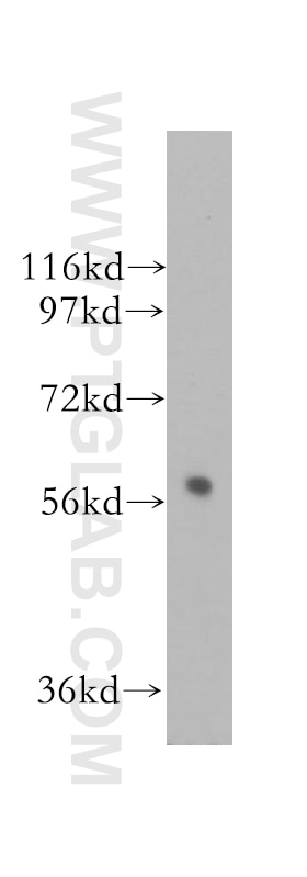 Western Blot (WB) analysis of human brain tissue using ALDH4A1 Polyclonal antibody (11604-1-AP)