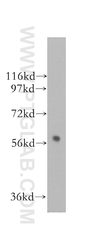 WB analysis of human brain using 11604-1-AP