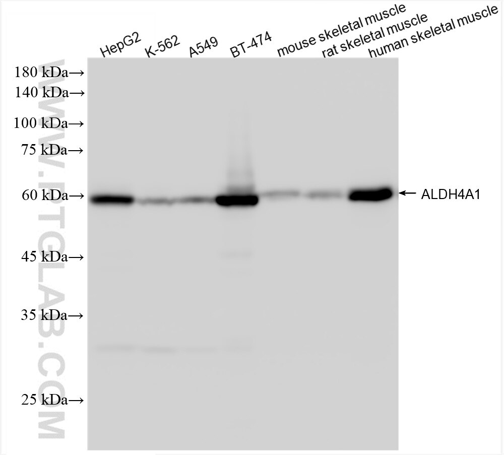 Western Blot (WB) analysis of various lysates using ALDH4A1 Recombinant antibody (86297-1-RR)