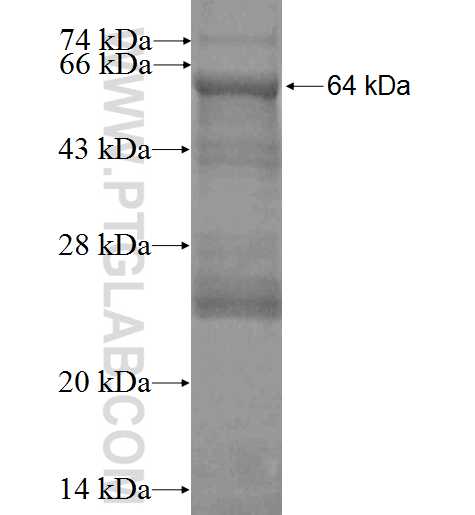 ALDH4A1 fusion protein Ag2147 SDS-PAGE