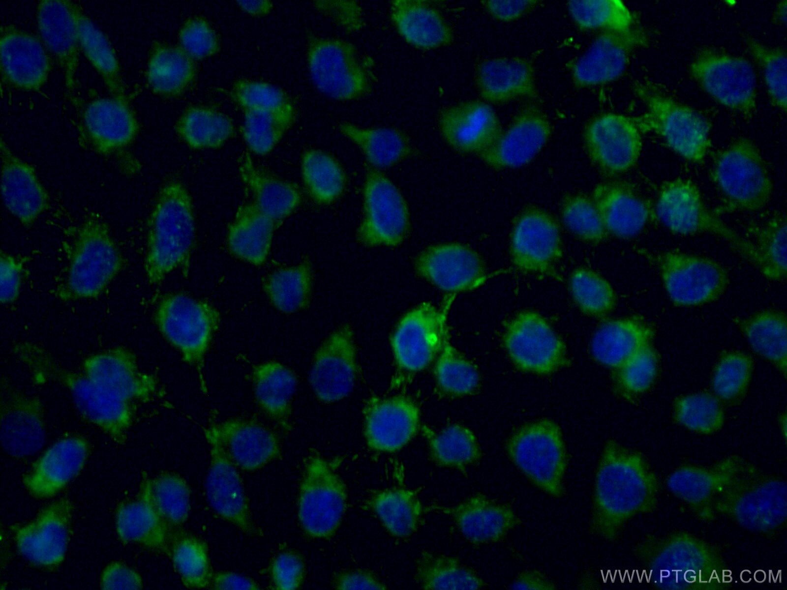 Immunofluorescence (IF) / fluorescent staining of A431 cells using ALDH5A1 Polyclonal antibody (17319-1-AP)