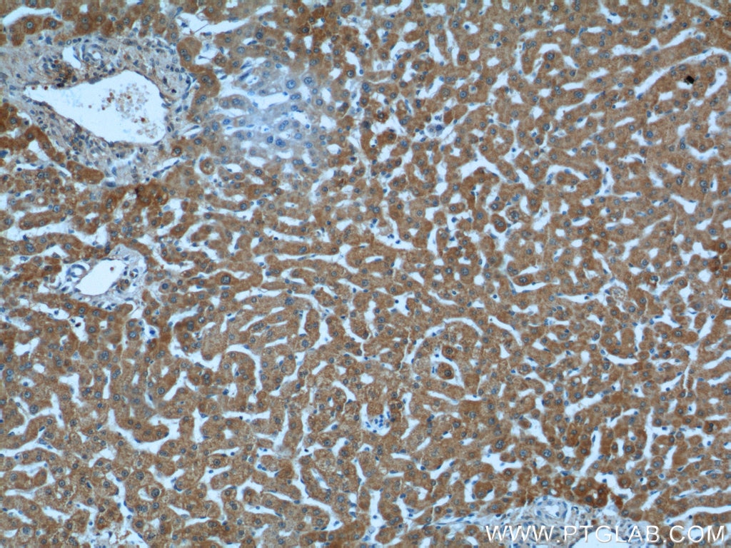 Immunohistochemistry (IHC) staining of human liver tissue using ALDH5A1 Polyclonal antibody (17319-1-AP)