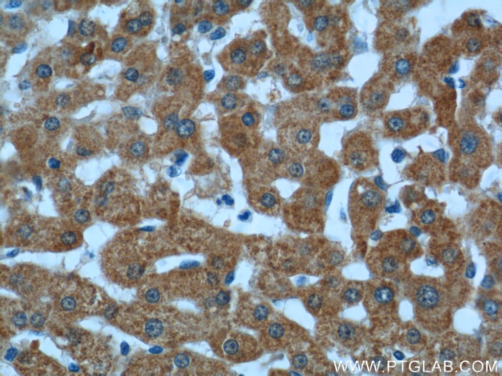 Immunohistochemistry (IHC) staining of human liver tissue using ALDH5A1 Polyclonal antibody (17319-1-AP)