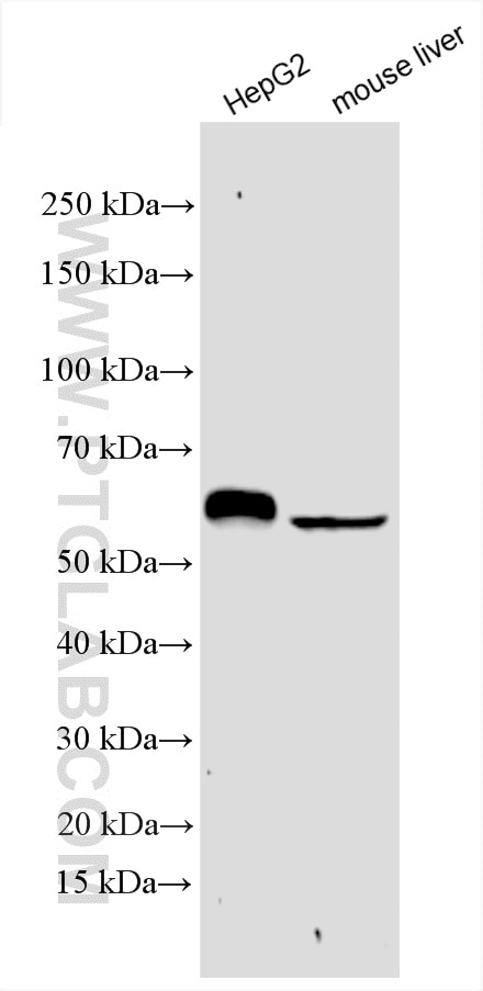 Western Blot (WB) analysis of various lysates using ALDH5A1 Polyclonal antibody (17319-1-AP)