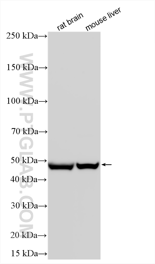 WB analysis using 17319-1-AP Western Blot (WB) analysis of various lysates using ALDH5A1 Polyclonal antibody (17319-1-AP)