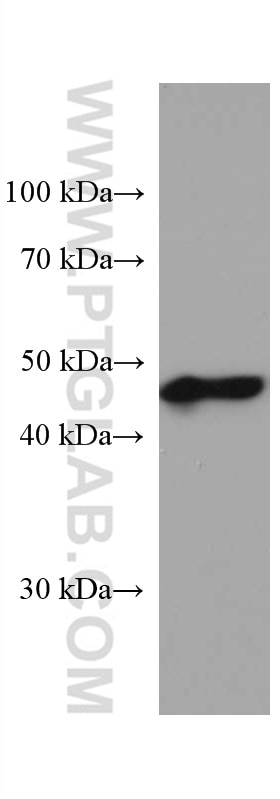Western Blot (WB) analysis of pig brain tissue using ALDH5A1 Monoclonal antibody (67347-1-Ig)