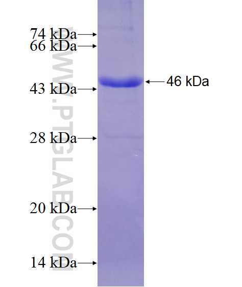 ALDH5A1 fusion protein Ag11155 SDS-PAGE