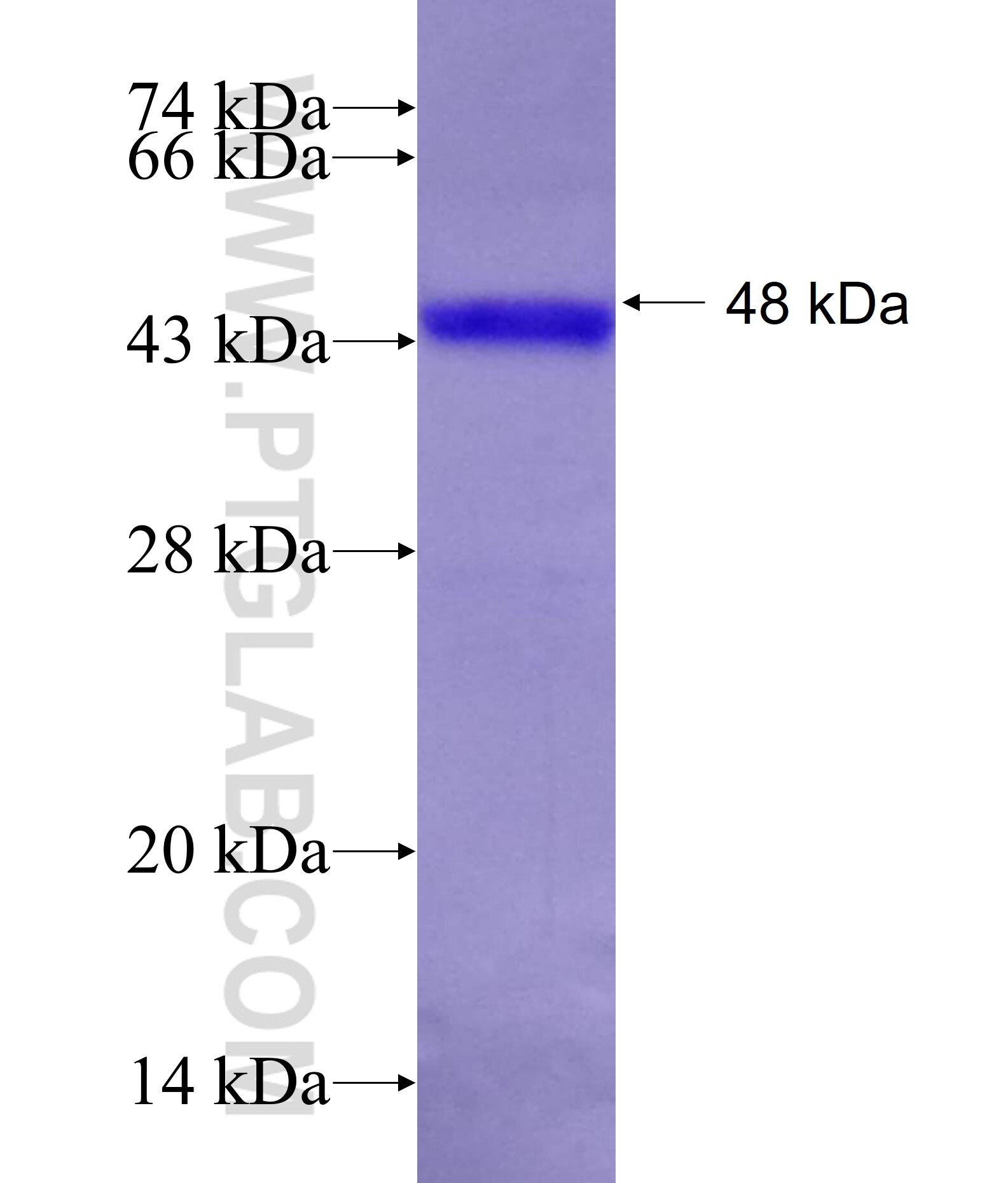 ALDH5A1 fusion protein Ag11155 SDS-PAGE