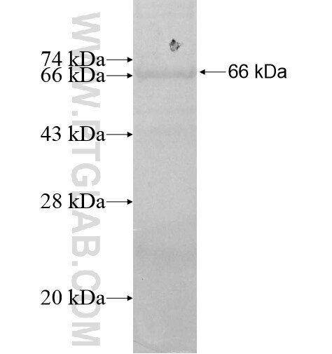 ALDH5A1 fusion protein Ag11293 SDS-PAGE