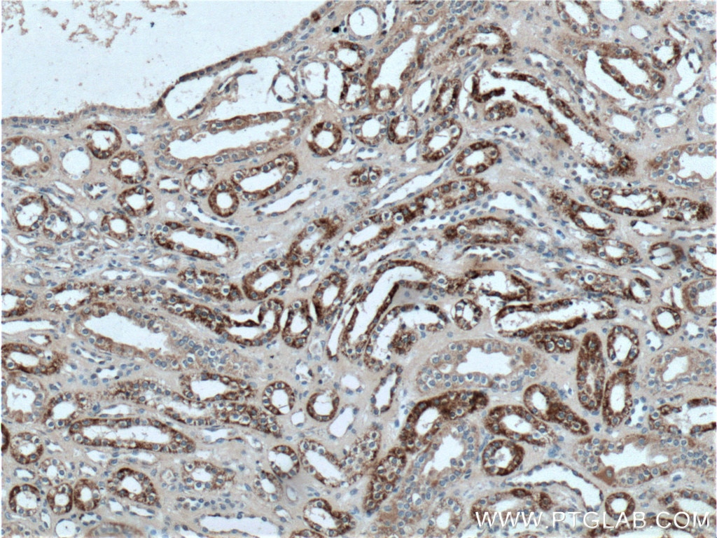 Immunohistochemistry (IHC) staining of human kidney tissue using ALDH6A1 Polyclonal antibody (20452-1-AP)