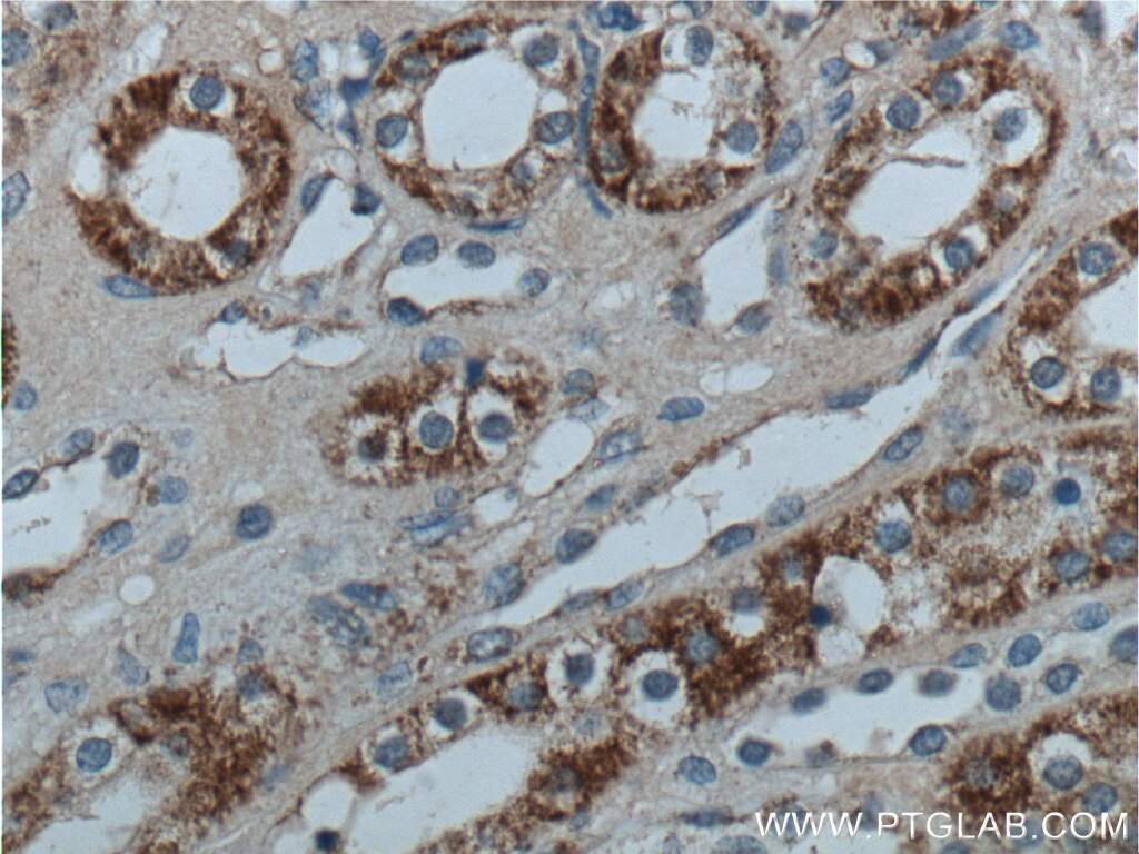 Immunohistochemistry (IHC) staining of human kidney tissue using ALDH6A1 Polyclonal antibody (20452-1-AP)