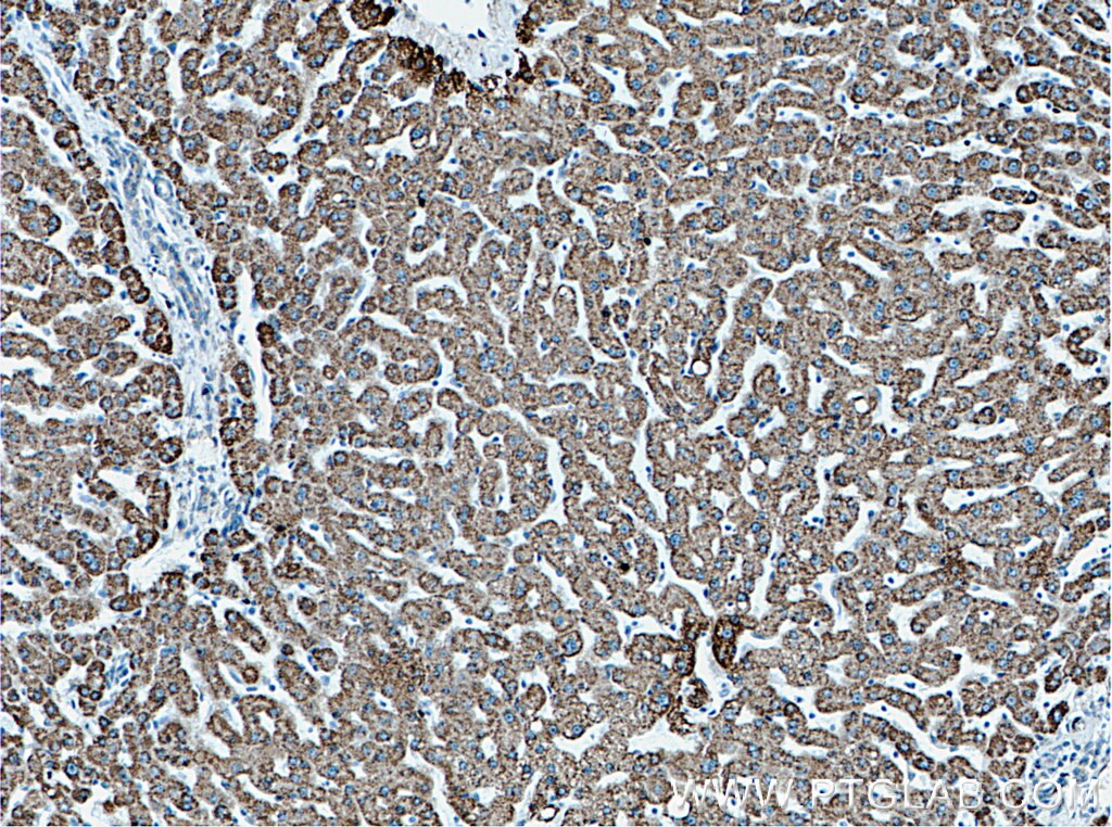 IHC staining of human liver using 20452-1-AP