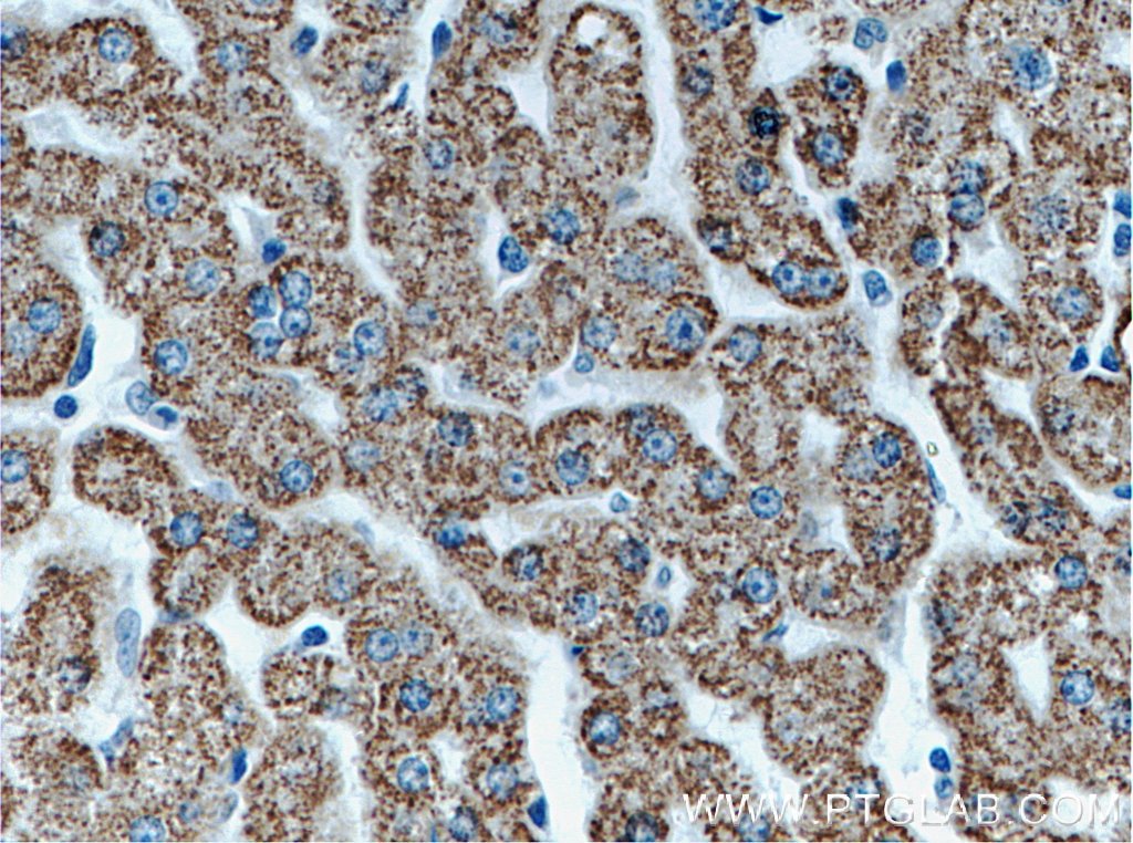 Immunohistochemistry (IHC) staining of human liver tissue using ALDH6A1 Polyclonal antibody (20452-1-AP)