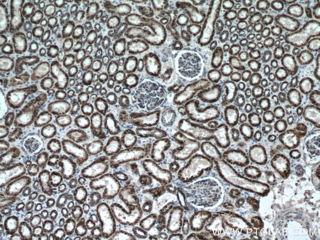 Immunohistochemistry (IHC) staining of human kidney tissue using ALDH6A1 Polyclonal antibody (20452-1-AP)