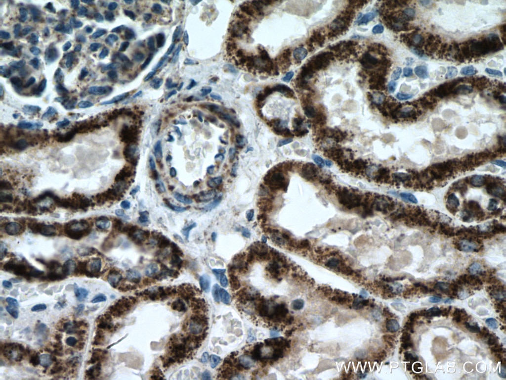 Immunohistochemistry (IHC) staining of human kidney tissue using ALDH6A1 Polyclonal antibody (20452-1-AP)