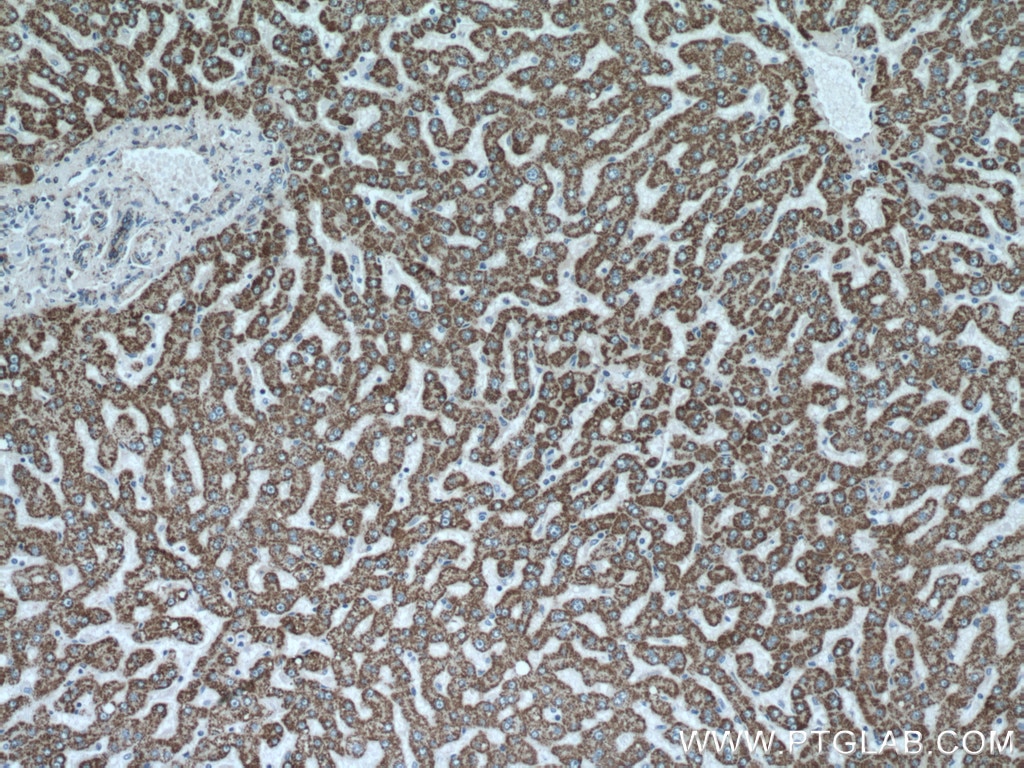 Immunohistochemistry (IHC) staining of human liver tissue using ALDH6A1 Polyclonal antibody (20452-1-AP)