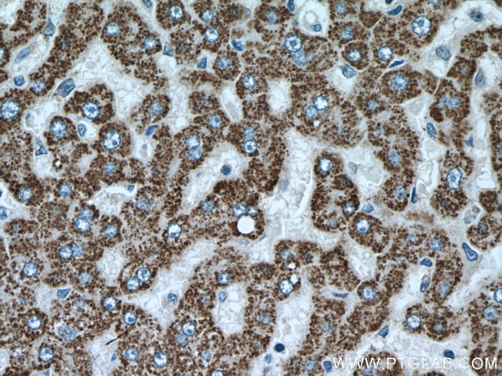 Immunohistochemistry (IHC) staining of human liver tissue using ALDH6A1 Polyclonal antibody (20452-1-AP)