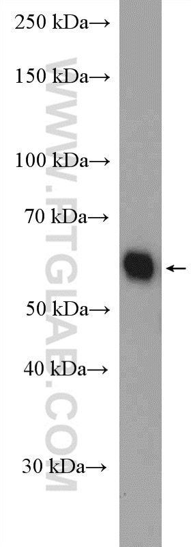 Western Blot (WB) analysis of mouse heart tissue using ALDH6A1 Polyclonal antibody (20452-1-AP)