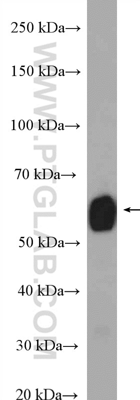 Western Blot (WB) analysis of mouse kidney tissue using ALDH6A1 Polyclonal antibody (20452-1-AP)
