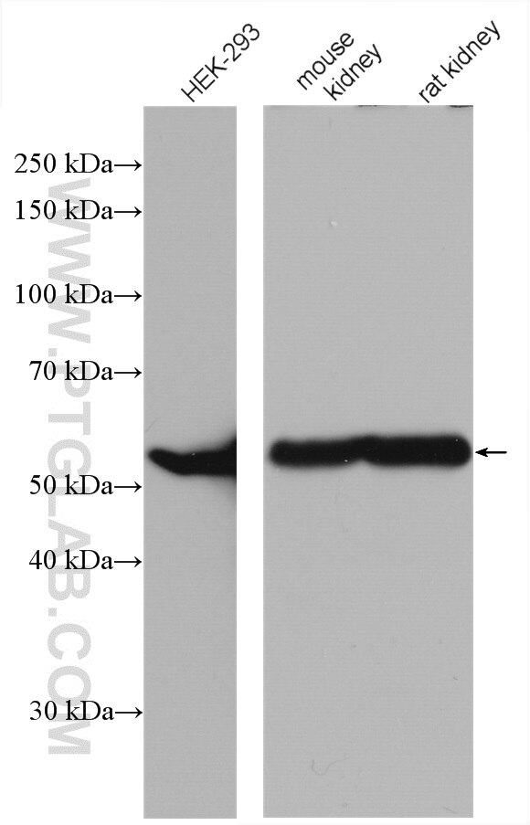 Western Blot (WB) analysis of various lysates using ALDH6A1 Polyclonal antibody (20452-1-AP)