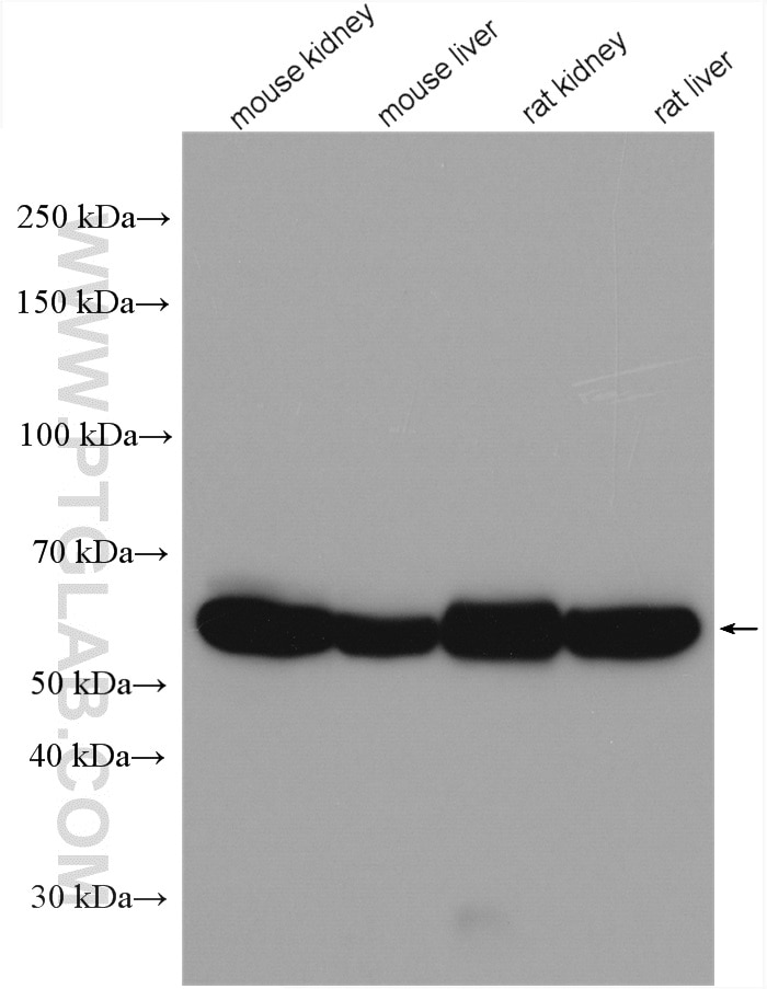 Western Blot (WB) analysis of various lysates using ALDH6A1 Polyclonal antibody (20452-1-AP)