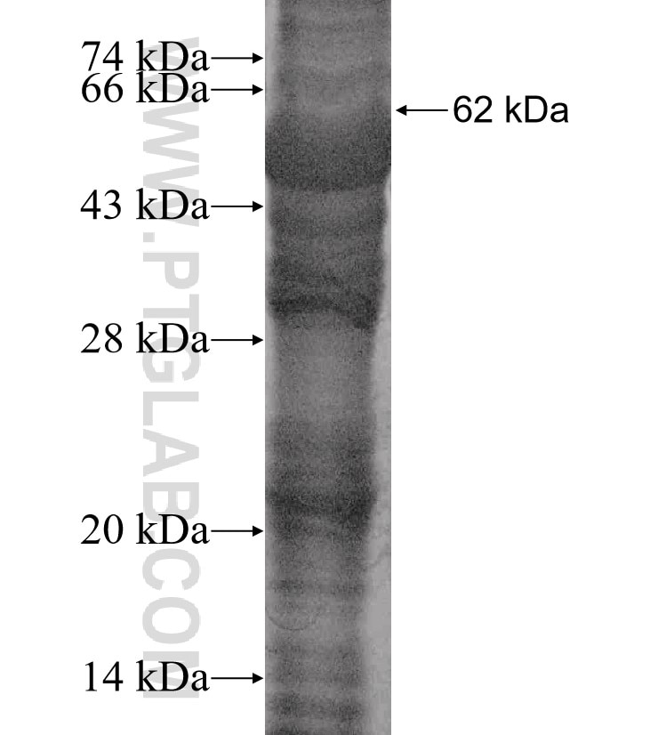 ALDH6A1 fusion protein Ag13879 SDS-PAGE