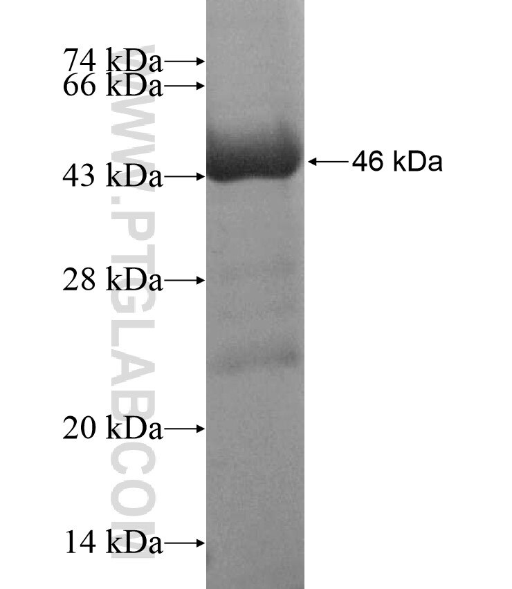 ALDH6A1 fusion protein Ag16991 SDS-PAGE