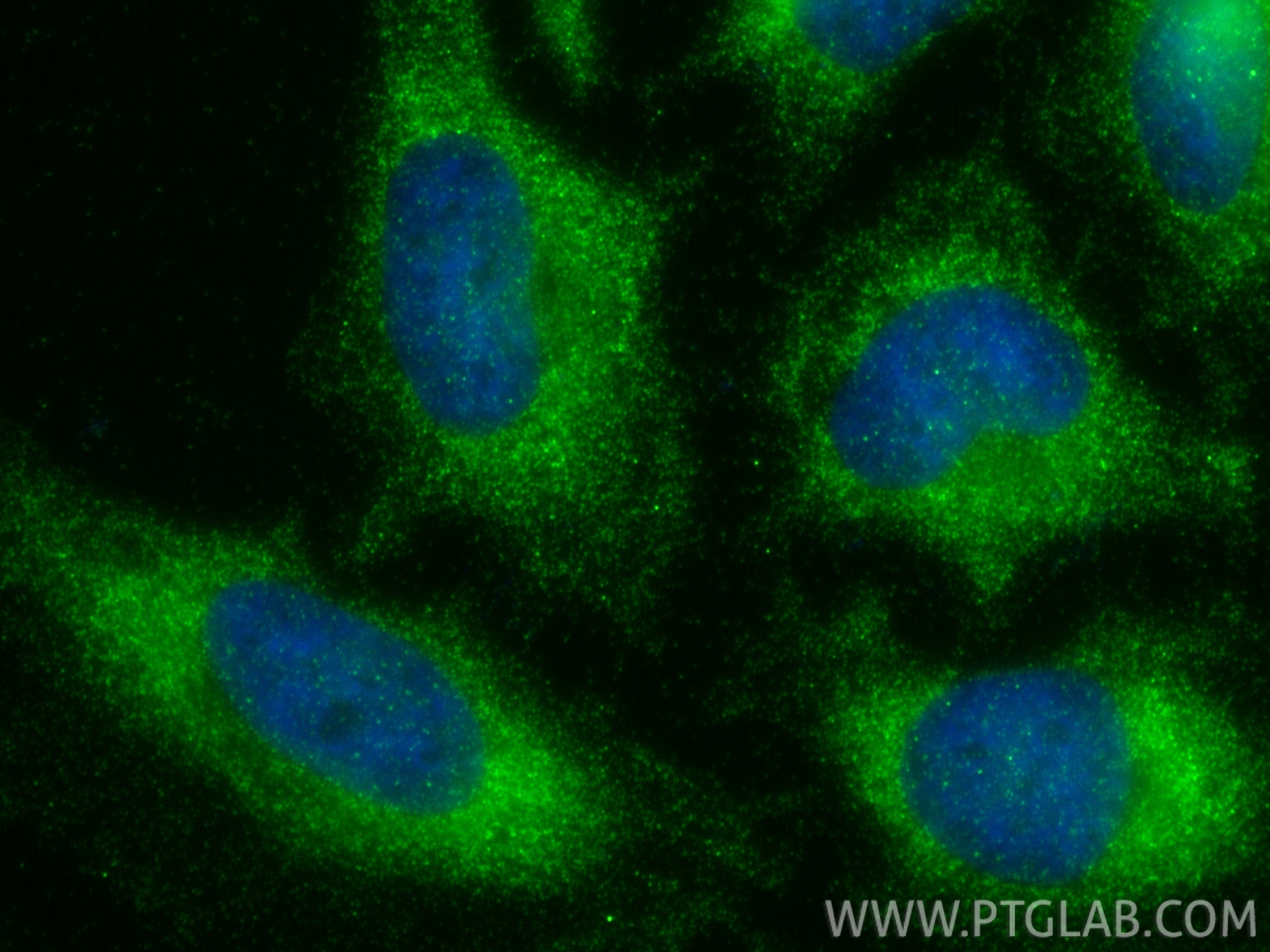 Immunofluorescence (IF) / fluorescent staining of HeLa cells using ALDH7A1 Polyclonal antibody (10368-1-AP)