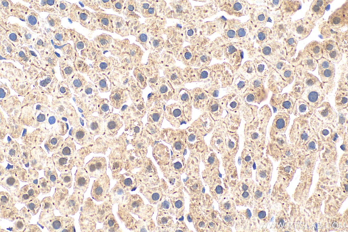 Immunohistochemistry (IHC) staining of rat liver tissue using ALDH7A1 Polyclonal antibody (10368-1-AP)