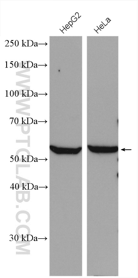Western Blot (WB) analysis of various lysates using ALDH7A1 Polyclonal antibody (10368-1-AP)