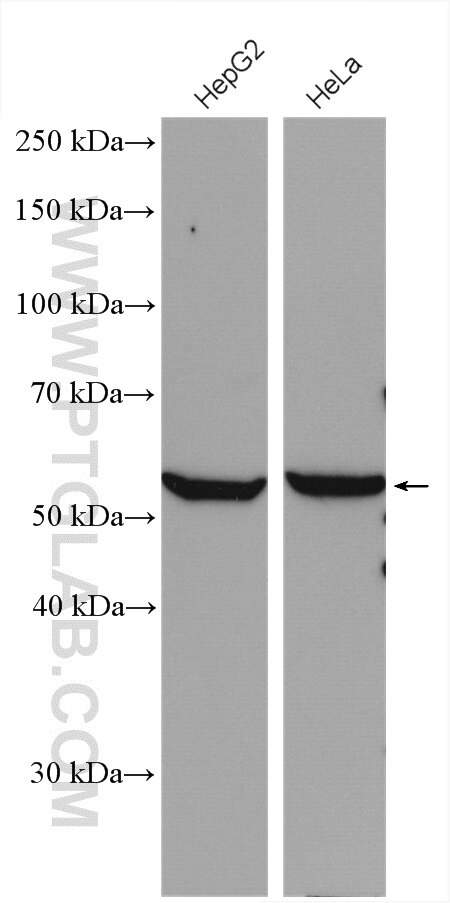 Western Blot (WB) analysis of various lysates using ALDH7A1 Polyclonal antibody (10368-1-AP)