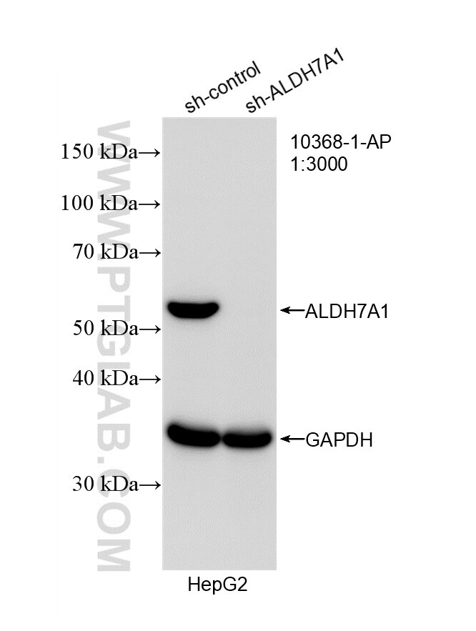 Western Blot (WB) analysis of HepG2 cells using ALDH7A1 Polyclonal antibody (10368-1-AP)