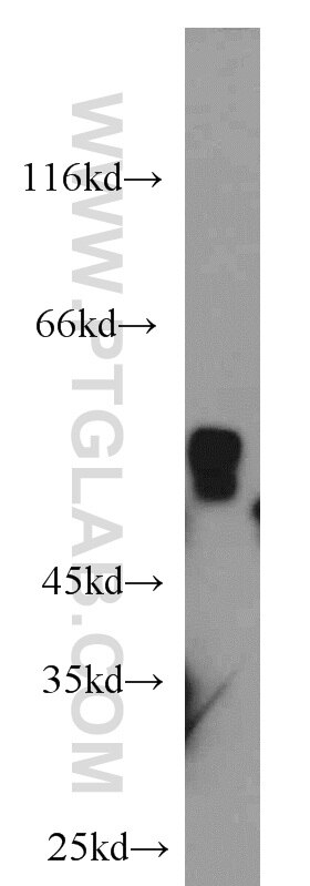 Western Blot (WB) analysis of mouse kidney tissue using ALDH7A1 Polyclonal antibody (10368-1-AP)