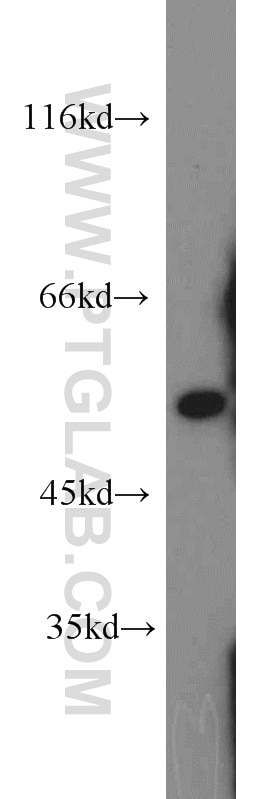 Western Blot (WB) analysis of mouse liver tissue using ALDH7A1 Polyclonal antibody (10368-1-AP)