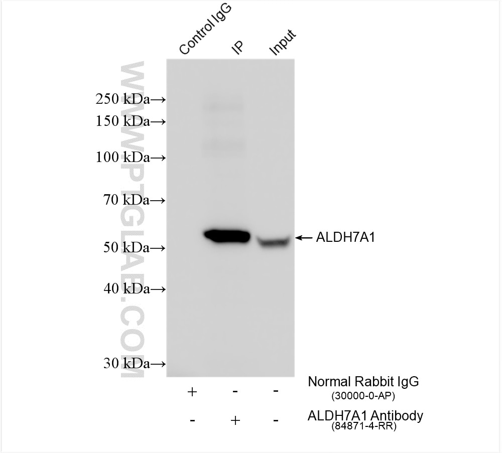 Immunoprecipitation (IP) experiment of HeLa cells using ALDH7A1 Recombinant antibody (84871-4-RR)