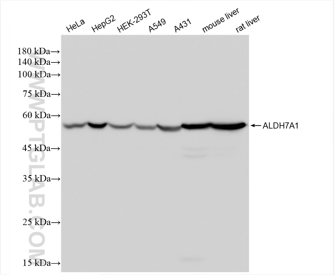Western Blot (WB) analysis of various lysates using ALDH7A1 Recombinant antibody (84871-4-RR)
