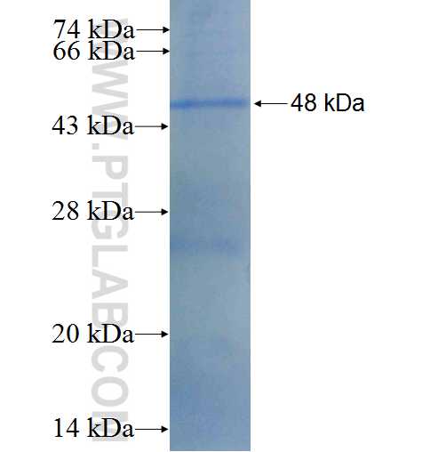ALDH7A1 fusion protein Ag0383 SDS-PAGE