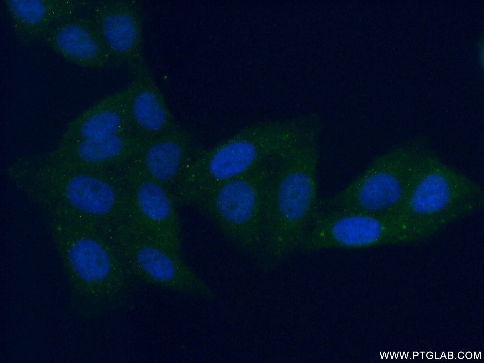 Immunofluorescence (IF) / fluorescent staining of HepG2 cells using ALDH8A1 Polyclonal antibody (21602-1-AP)