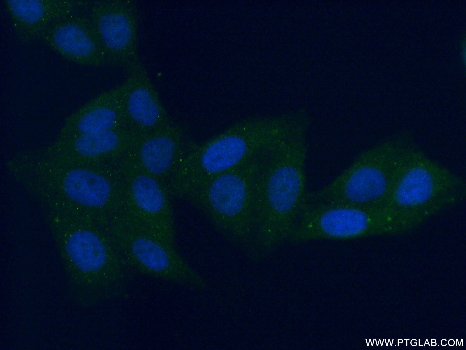 IF Staining of HepG2 using 21602-1-AP