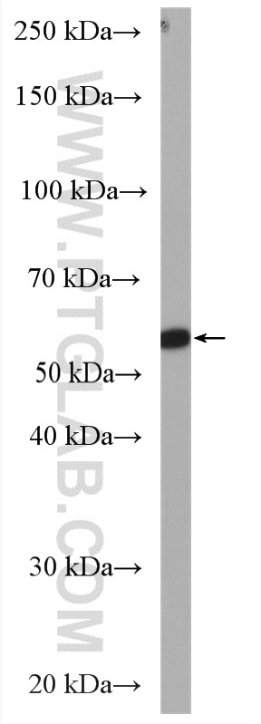 Western Blot (WB) analysis of L02 cells using ALDH8A1 Polyclonal antibody (21602-1-AP)