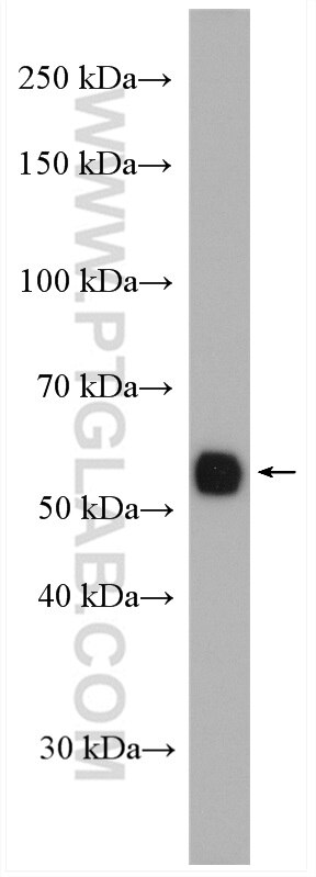 Western Blot (WB) analysis of mouse kidney tissue using ALDH8A1 Polyclonal antibody (21602-1-AP)