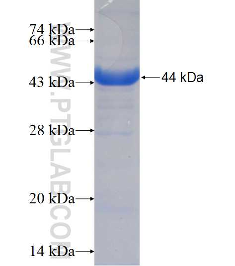 ALDH8A1 fusion protein Ag17002 SDS-PAGE