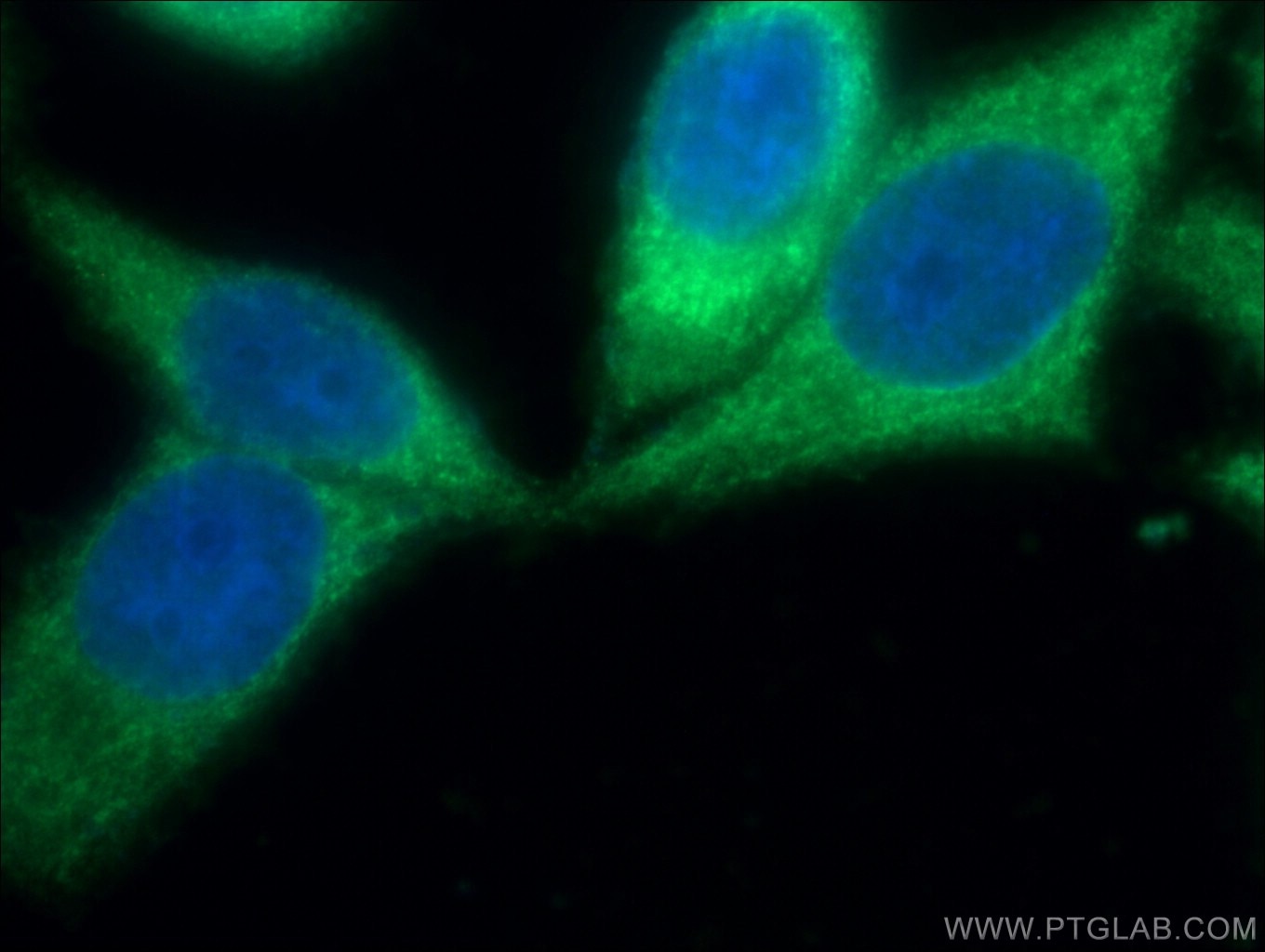 Immunofluorescence (IF) / fluorescent staining of HeLa cells using ALDH9A1 Polyclonal antibody (26621-1-AP)