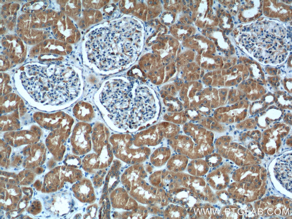 Immunohistochemistry (IHC) staining of human kidney tissue using ALDH9A1 Polyclonal antibody (26621-1-AP)